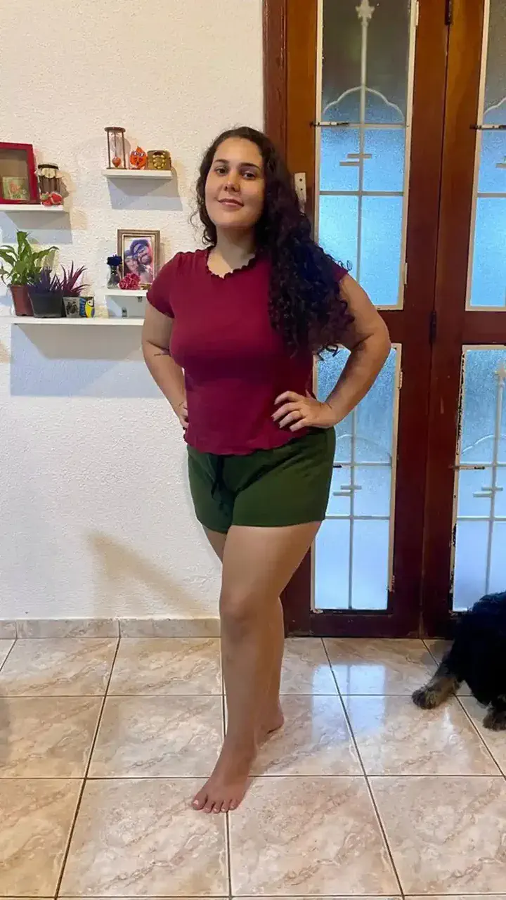 Bianca depois do tratamento